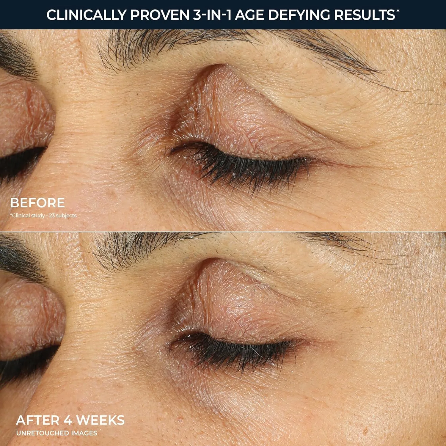 RoC Retinol Correxion Under Eye Cream